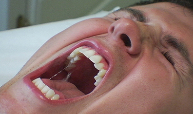 A teenage boy howls in pain in "Hard," an episode of the CBC kids show Nerve.